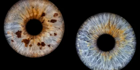 Zwei Iriden als Wandbild – Klassisch – Irisfotografie von JALES – feine Motive in Münster