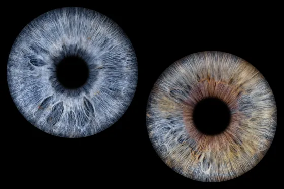 Zwei Iriden als Wandbild – Klassisch – Irisfotografie von JALES – feine Motive in Münster