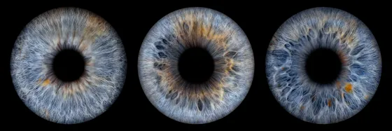 Drei Iriden als Wandbild – Klassisch – Irisfotografie von JALES – feine Motive in Münster