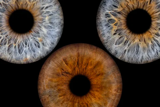 Drei Iriden als Wandbild – Klassisch – Irisfotografie von JALES – feine Motive in Münster