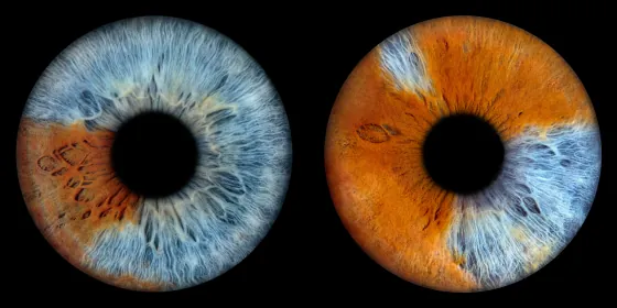 Zwei Iriden als Wandbild – Klassisch – Irisfotografie von JALES – feine Motive in Münster
