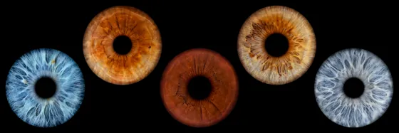 Fünf Iriden als Wandbild – Klassisch – Irisfotografie von JALES – feine Motive in Münster