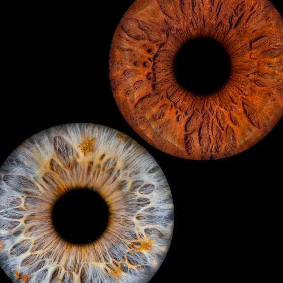 Zwei Iriden als Wandbild – Klassisch – Irisfotografie von JALES – feine Motive in Münster
