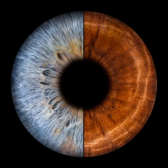 Zwei Iriden als Wandbild – Klassisch – Irisfotografie von JALES – feine Motive in Münster