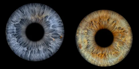 Zwei Iriden als Wandbild – Klassisch – Irisfotografie von JALES – feine Motive in Münster