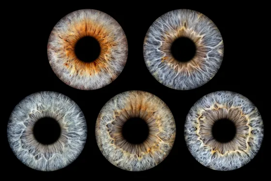 Fünf Iriden als Wandbild – Klassisch – Irisfotografie von JALES – feine Motive in Münster