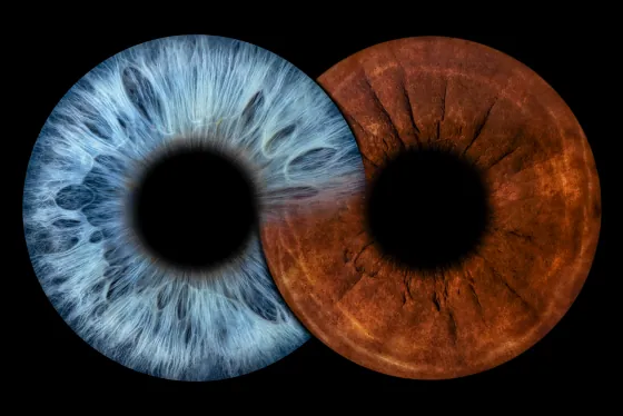 Zwei Iriden als Wandbild – Unendlichkeit – Irisfotografie von JALES – feine Motive in Münster