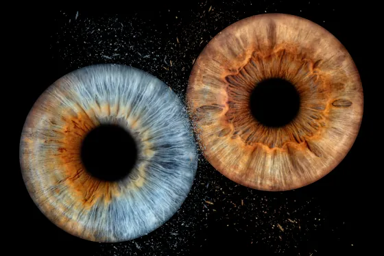 Zwei Iriden als Wandbild – Explosion – Irisfotografie von JALES – feine Motive in Münster