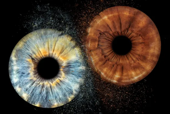 Zwei Iriden als Wandbild – Explosion – Irisfotografie von JALES – feine Motive in Münster
