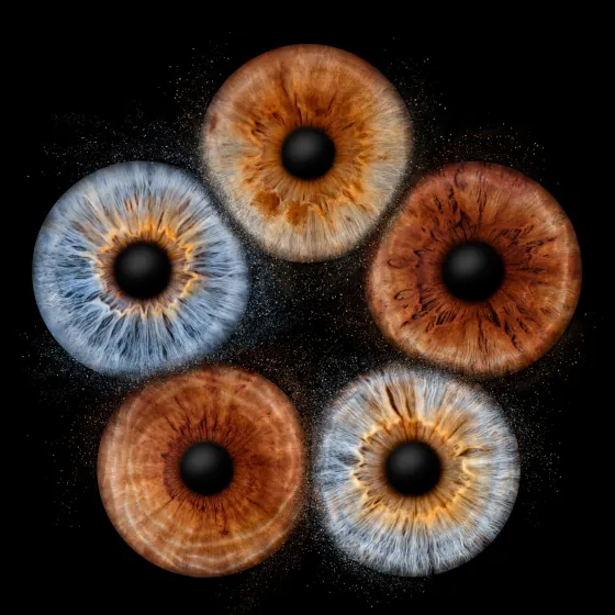 Fünf Iriden als Wandbild – Explosion – Irisfotografie von JALES – feine Motive in Münster