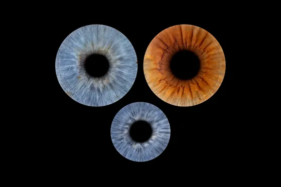 Drei Iriden auf Schwarz, oben eine blaugraue und eine kupferbraune, darunter eine kleinere blaugraue – Iris-Wandbild Artikel 0169, Familienfoto